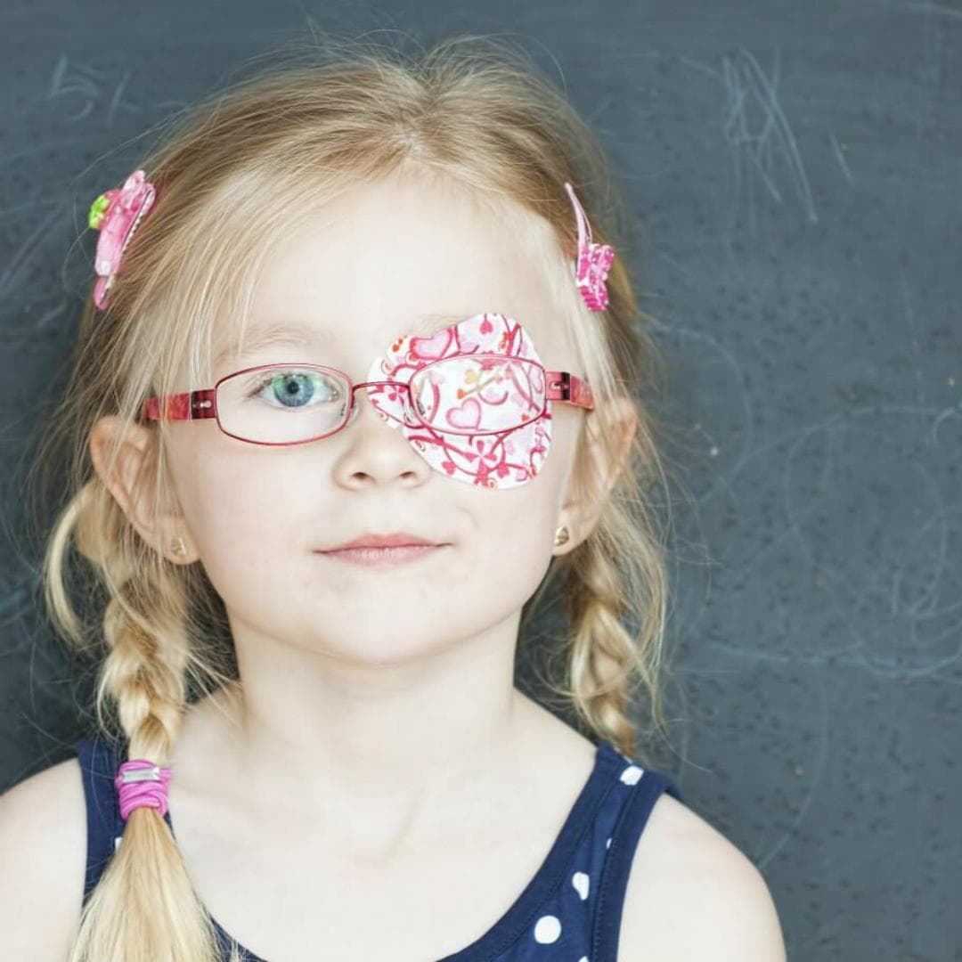 Slabovidost / Ambliopija i lenje oko